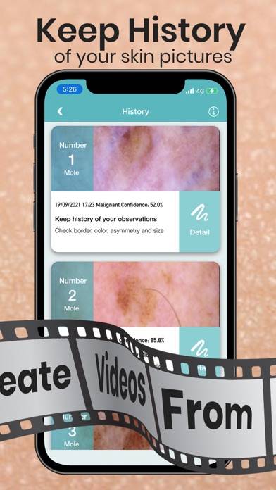Mole Checker Skin Dermatology Capture d'écran de l'application #4