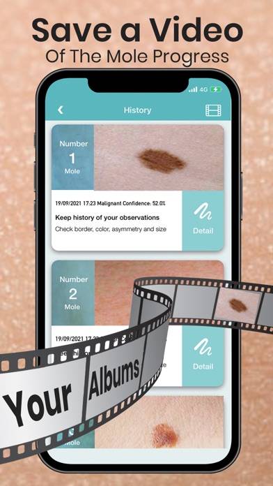 Mole Checker Skin Dermatology Capture d'écran de l'application #5