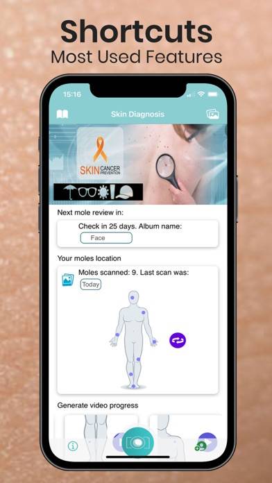 Mole Checker Skin Dermatology Capture d'écran de l'application #6