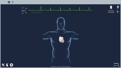 Epicardio Heart Simulator Capture d'écran de l'application #1