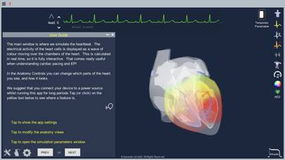 Epicardio Heart Simulator Schermata dell'app #2