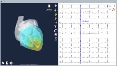 Epicardio Heart Simulator Schermata dell'app #3