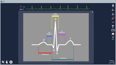 Epicardio Heart Simulator Schermata dell'app #4