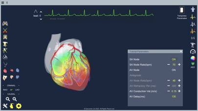 Epicardio Heart Simulator Capture d'écran de l'application #5