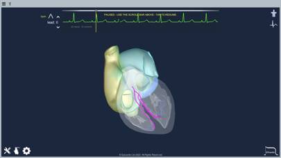 Epicardio Heart Simulator Schermata dell'app #6