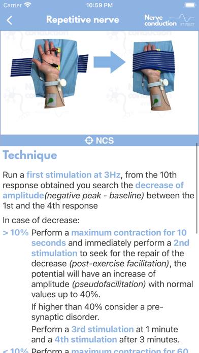 Nerve Conduction Studies Schermata dell'app #3