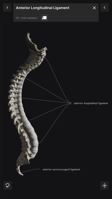 Biomechanics of the Spine Lite Uygulama ekran görüntüsü #3