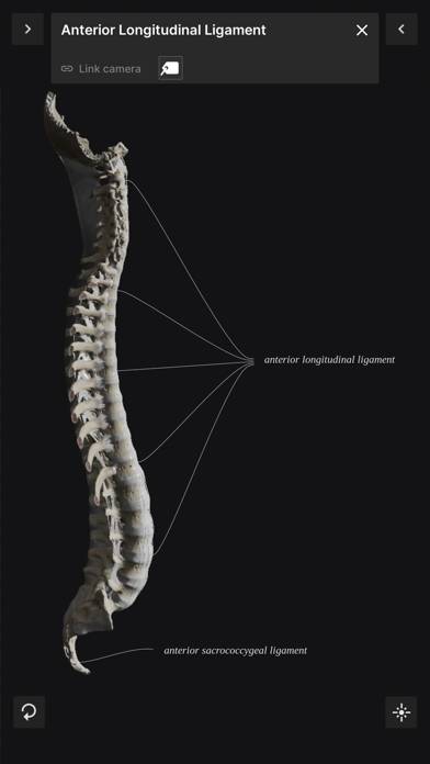 Biomechanics of the Spine Lite App screenshot #4