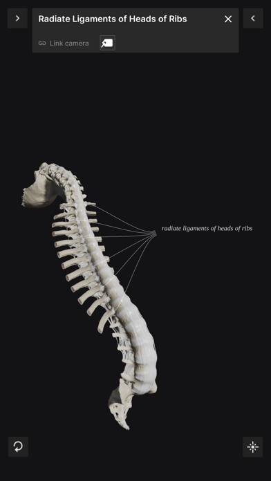 Biomechanics of the Spine Lite Schermata dell'app #6
