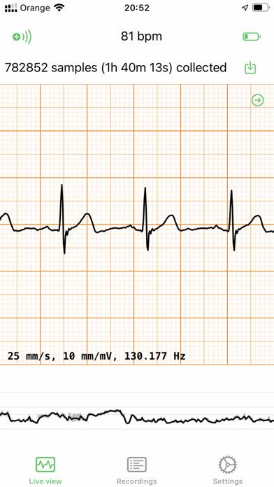 ECG EKG Viewer for Polar H10 Captura de pantalla de la aplicación #1