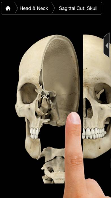 Skeleton System Pro III-iPhone