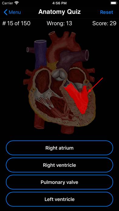 Anatomy Quiz App screenshot #2