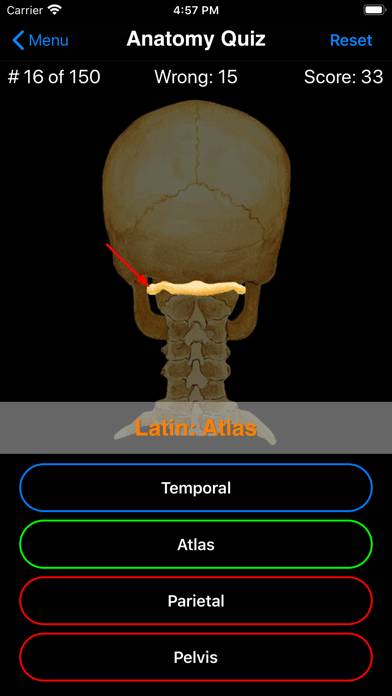 Anatomy Quiz Captura de pantalla de la aplicación #4