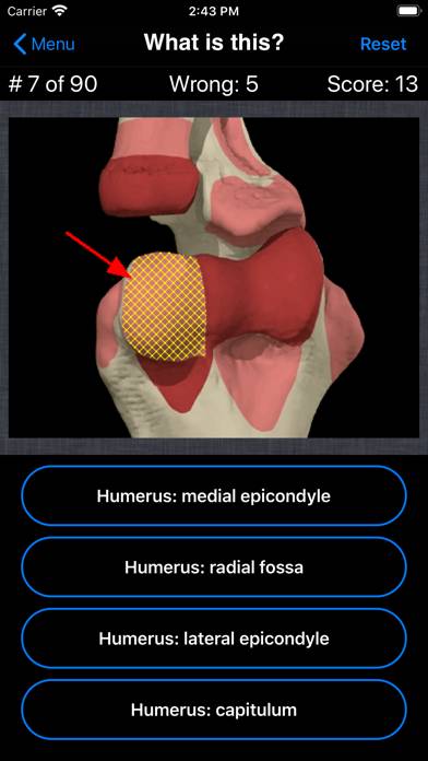 Anatomy Hand Quiz App skärmdump