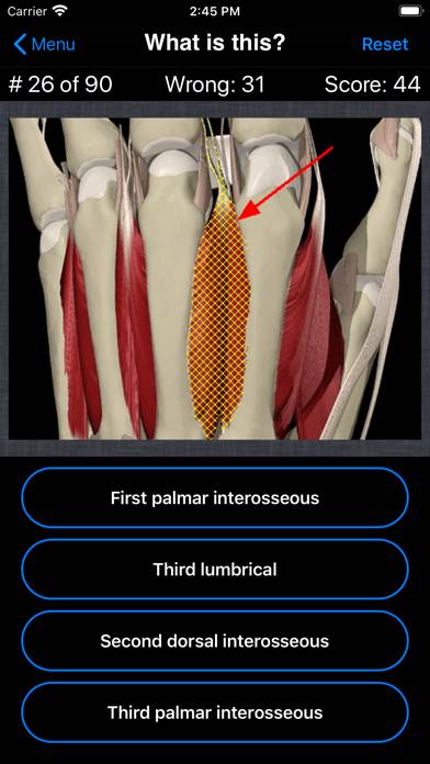 Anatomy Hand Quiz App skärmdump