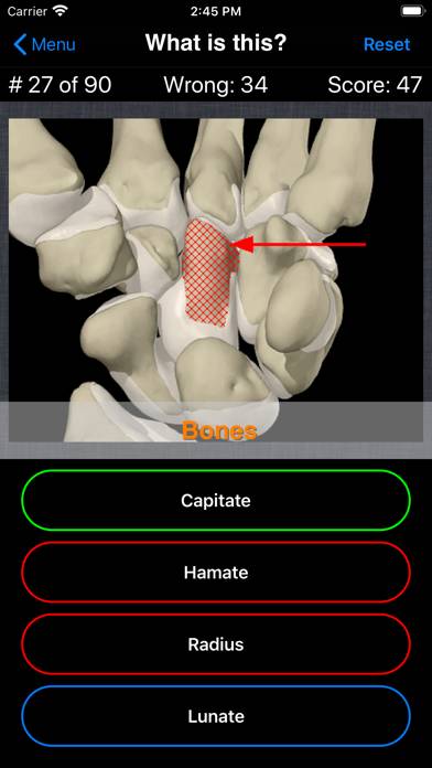 Anatomy Hand Quiz App skärmdump