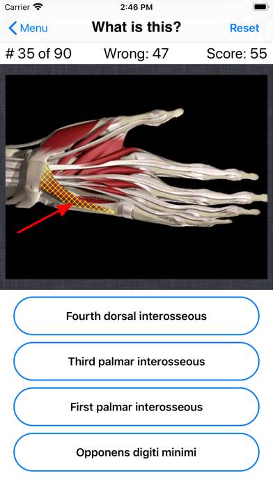 Anatomy Hand Quiz App skärmdump