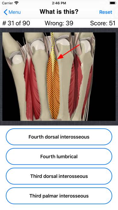 Anatomy Hand Quiz App skärmdump