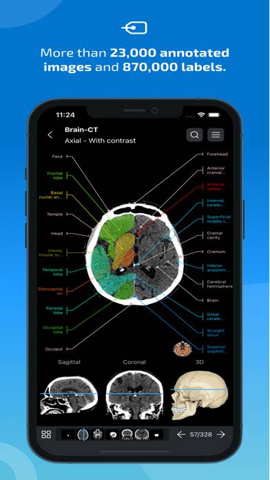 IMAIOS e-Anatomy Capture d'écran de l'application #2