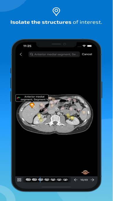 IMAIOS e-Anatomy Capture d'écran de l'application #4