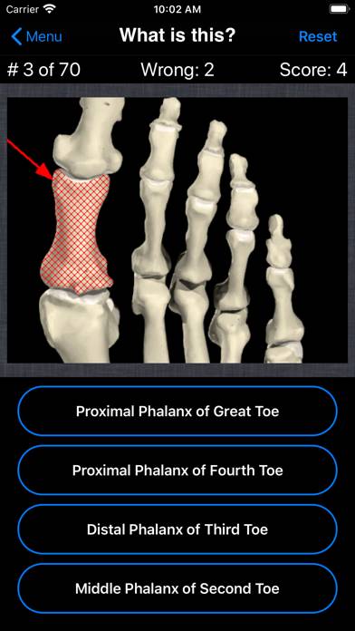 Anatomy Foot Quiz Capture d'écran de l'application #2