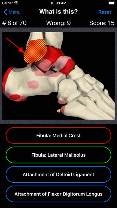 Anatomy Foot Quiz Capture d'écran de l'application #3