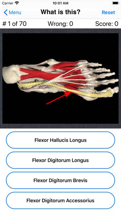 Anatomy Foot Quiz Capture d'écran de l'application #4