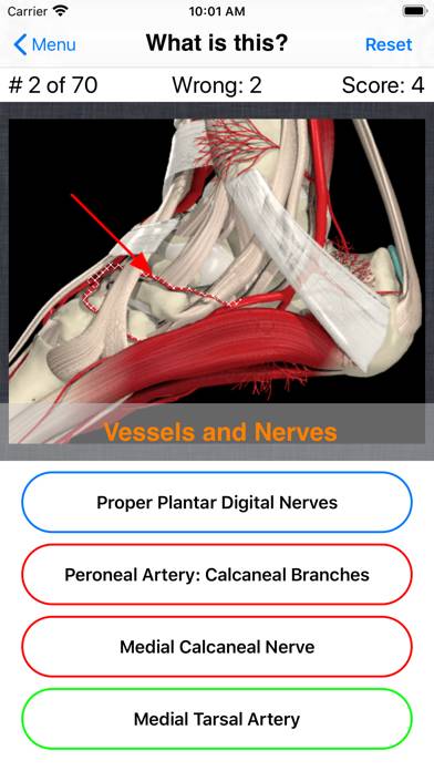 Anatomy Foot Quiz Capture d'écran de l'application #5