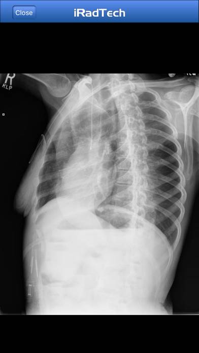 IRadTech App screenshot