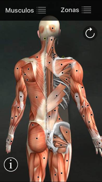Muscle Trigger Points App screenshot #1