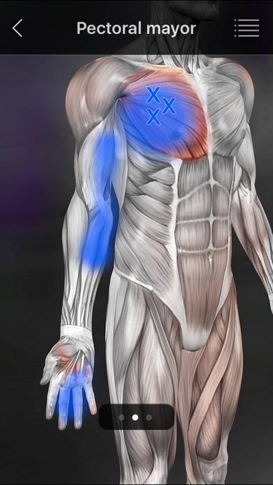 Muscle Trigger Points Schermata dell'app #2