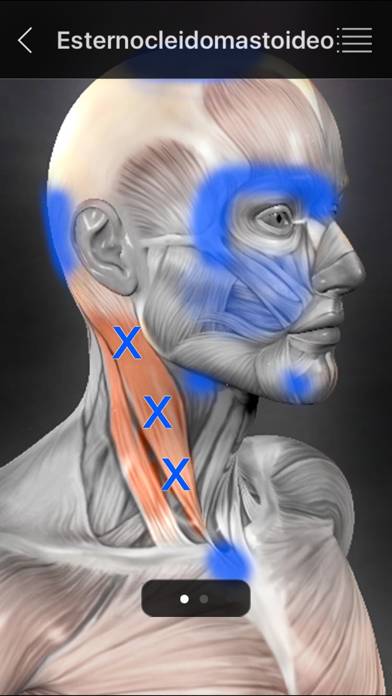 Muscle Trigger Points Schermata dell'app #4