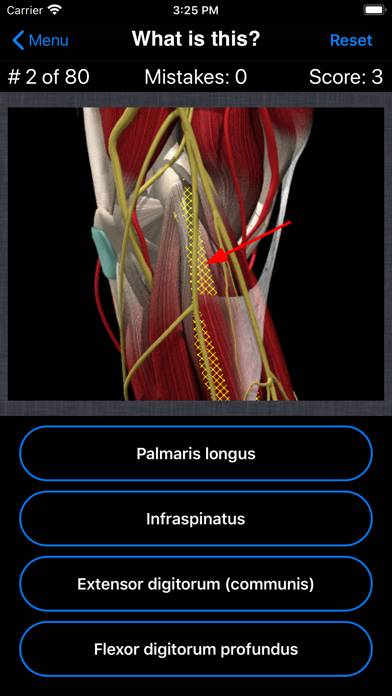 Anatomy Shoulder Quiz App skärmdump #2