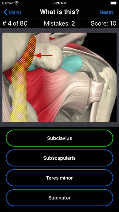 Anatomy Shoulder Quiz App skärmdump #3
