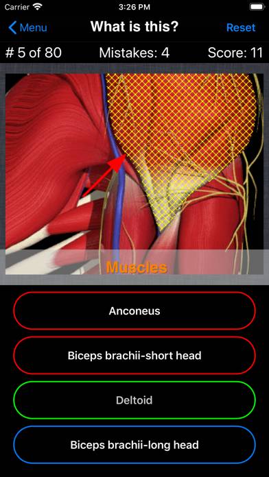 Anatomy Shoulder Quiz App skärmdump #4