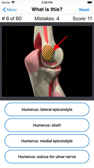 Anatomy Shoulder Quiz App skärmdump #5