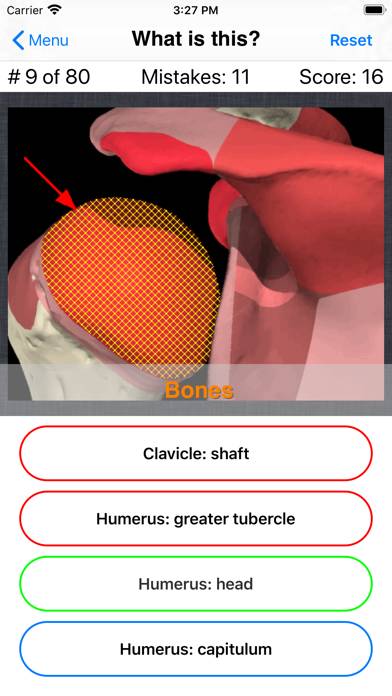 Anatomy Shoulder Quiz App skärmdump #6