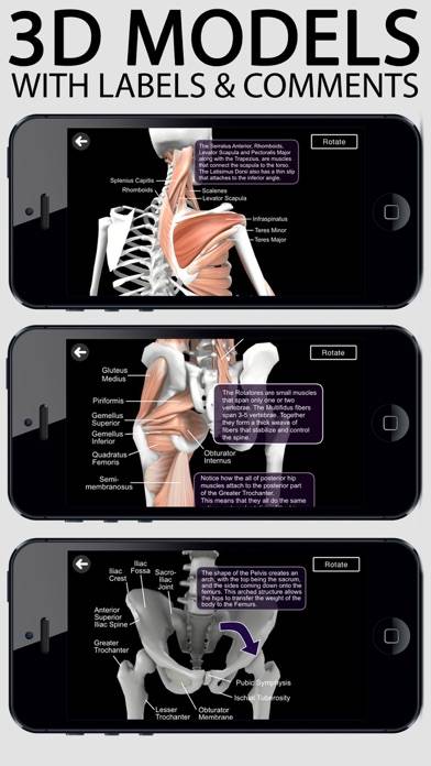 Learn Muscles: Anatomy Capture d'écran de l'application #1