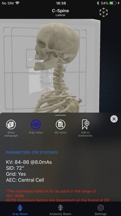 IRad Xrays Captura de pantalla de la aplicación