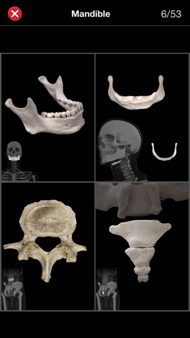 Anatomy Quiz Pro Capture d'écran de l'application #4