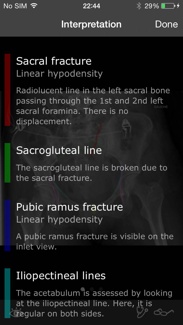 RealWorld Orthopaedics Скриншот приложения #3
