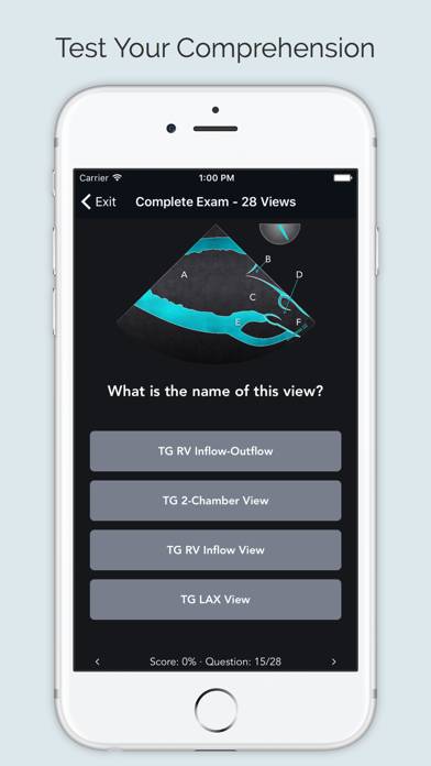 ECHO Views Captura de pantalla de la aplicación #4