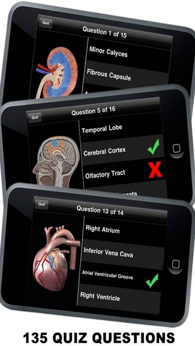 Anatomy 3D Скриншот приложения #3