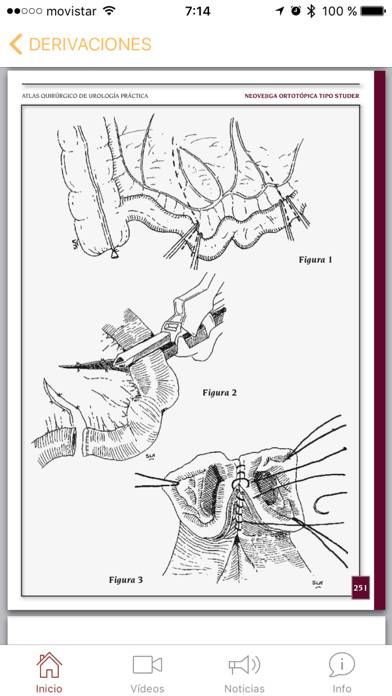 Atlas Quirúrgico de Urología Captura de pantalla de la aplicación #5
