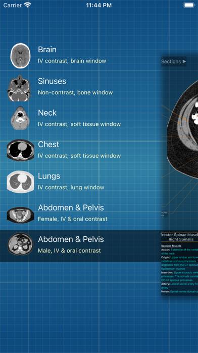 X-Anatomy Pro Uygulama ekran görüntüsü #1