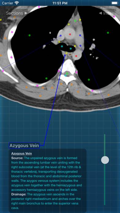 X-Anatomy Pro Schermata dell'app #4