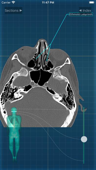 X-Anatomy Pro Schermata dell'app #5