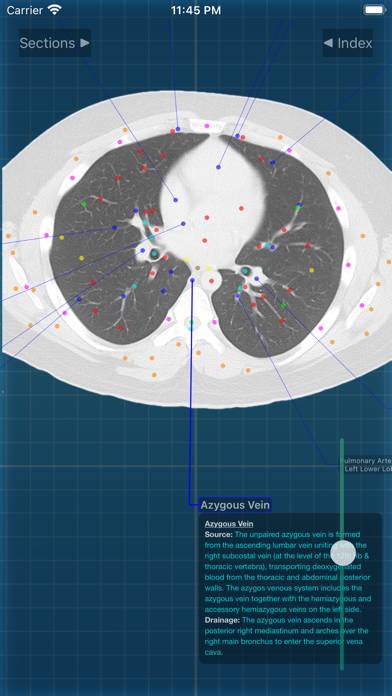 X-Anatomy Pro Schermata dell'app #6