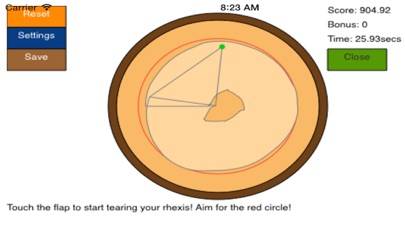 CataractMobile Schermata dell'app