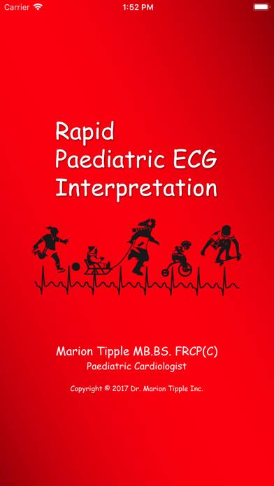Rapid Paed ECG